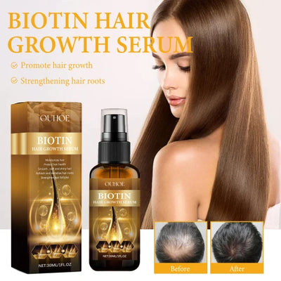 OUHOE Biotin Hair Growth Serum with Ginger Extract – Nourish & Repair Roots