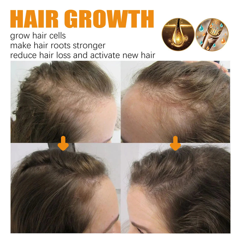 EELHOE Biotin Hair Growth Roll-On Oil | Nourishing Anti-Hair Loss Serum for Smooth & Glossy Hair – 10ml
