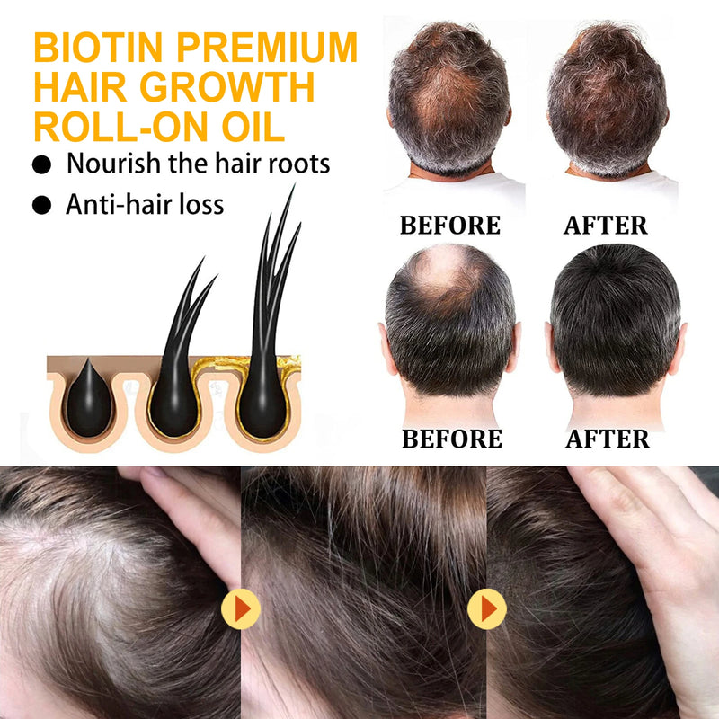EELHOE Biotin Hair Growth Roll-On Oil | Nourishing Anti-Hair Loss Serum for Smooth & Glossy Hair – 10ml