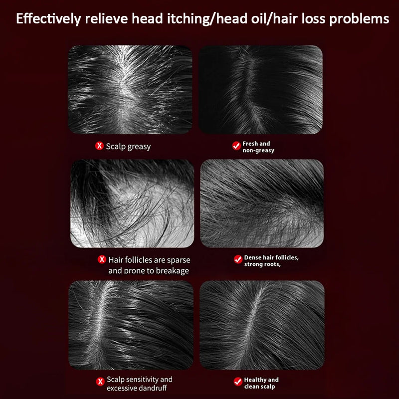 Electric Vibration Massage Comb Red Light Therapy Hair Growth Massage Scalp Brush Anti Hair Loss Liquid Oil Applicator Hair Care