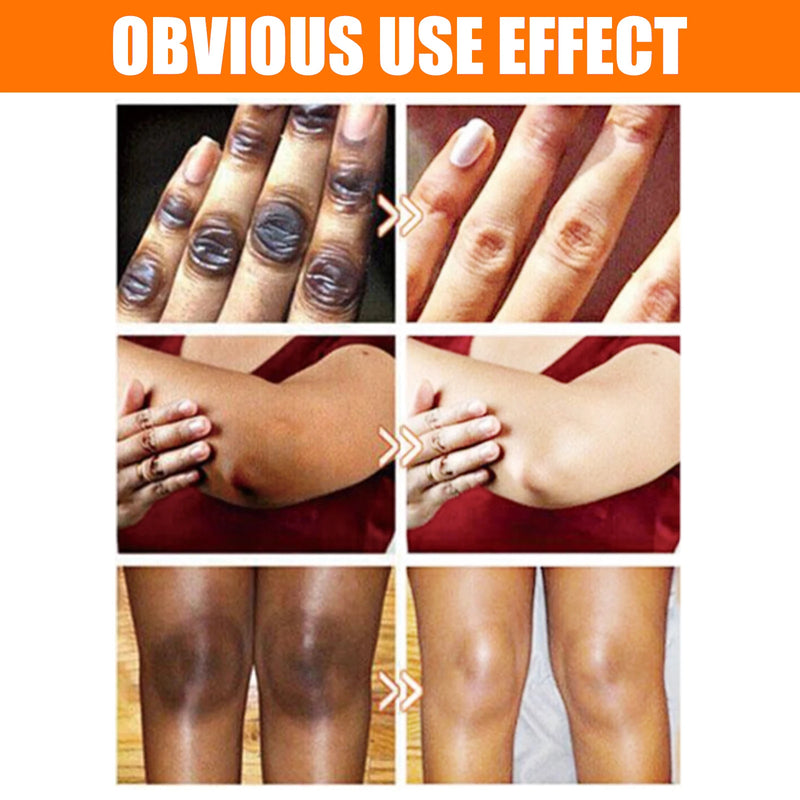 Brightening Serum  Skin Whitening, Hydrating, Dark Spot Removal, Glowing Face Treatment, Vitamin C Anti-Aging Essence for Women