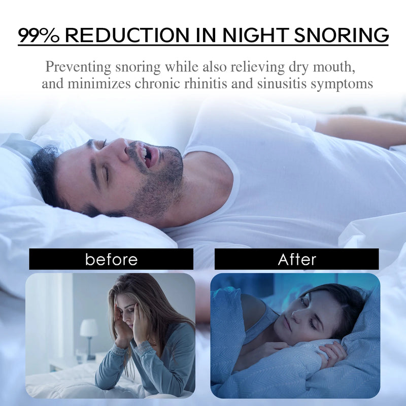 Stop Snoring Patch Nose Breathing Correction Promoting Better Breath Improve Sleeping Portable Night Sleep Mouth Orthosis Tape