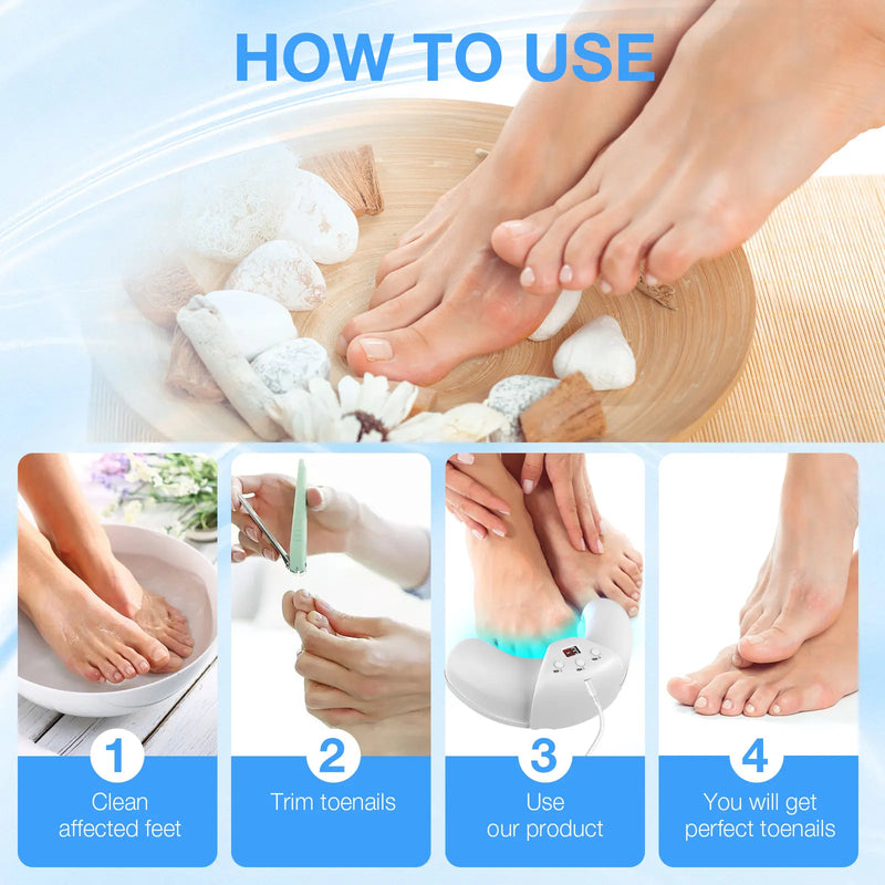 KTS Fungal Nail Laser Device Repair Fast Nails Fungus Onychomycosis Repair Toenail Fingernail Removes Nail Fungus Foot Care