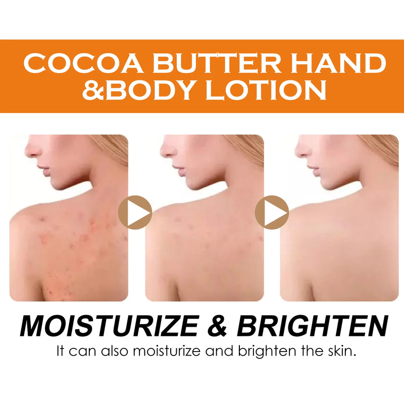 Cocoa Butter Body Lotion Dark Spot Corrector & Hydrating Moisturizer Brightening Cream Even Skin Tone Non-Greasy Fast Absorbing